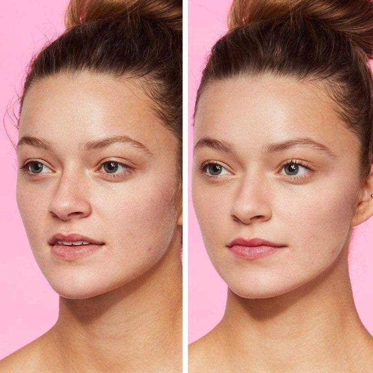 Before and after comparison of a woman's face on a pink background
