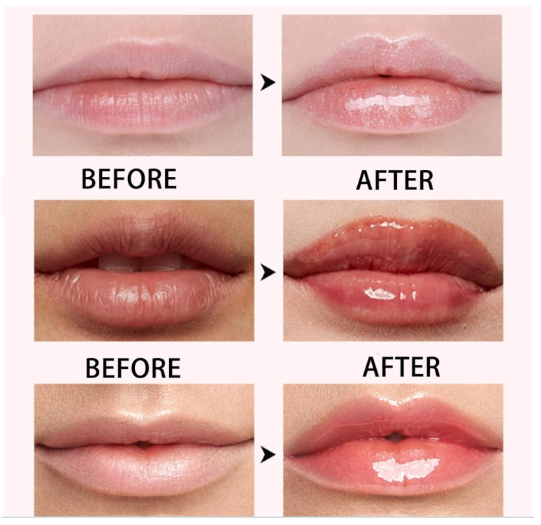 Before and after comparison of lips with a glossy lip product