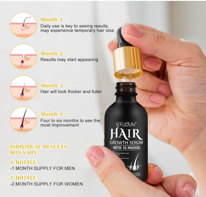 Hand holding a bottle of hair growth serum with dropper, showing product details and usage instructions.