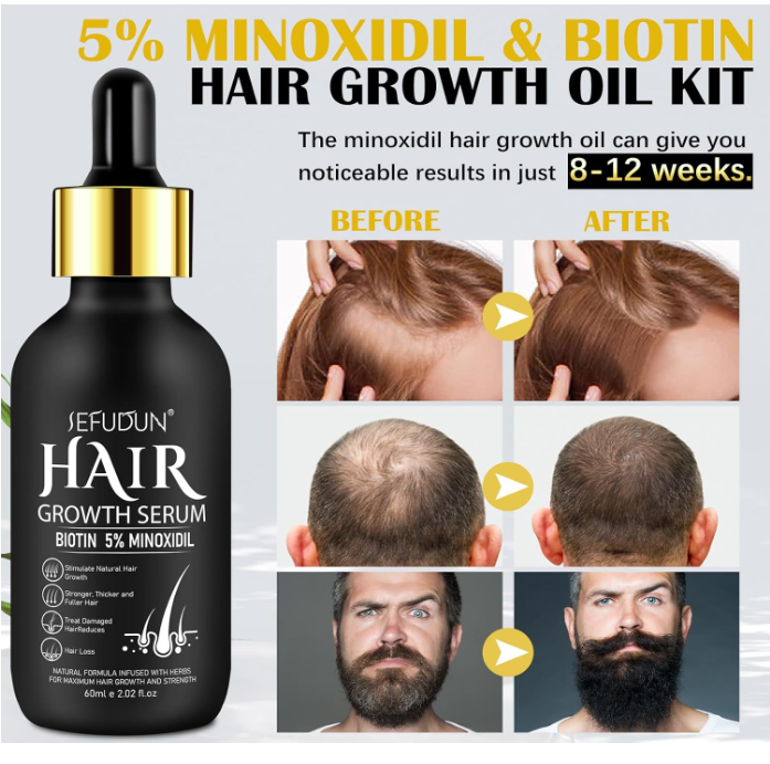 Hair growth serum bottle with before and after results on a white background