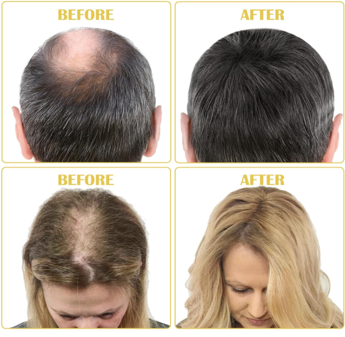 Before and after comparison of hair treatment on two people with different hair colors.