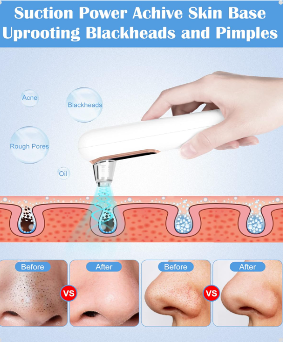 Product for suction-based blackhead and pimple removal with before and after images on a blue background.